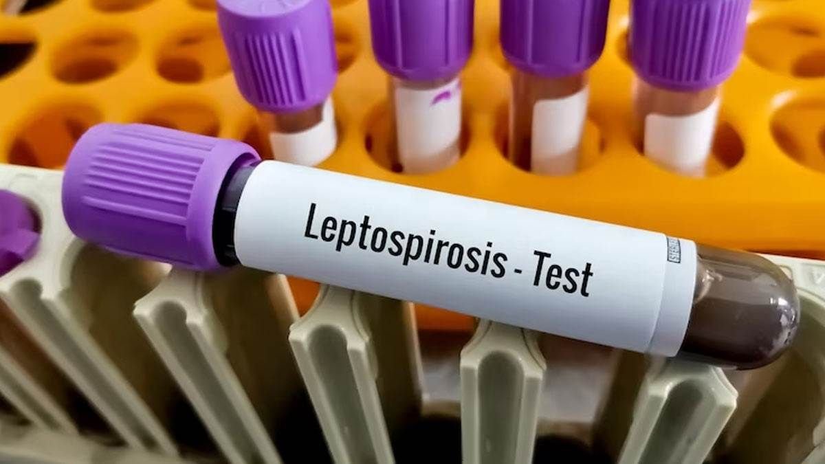 Leptospirosis